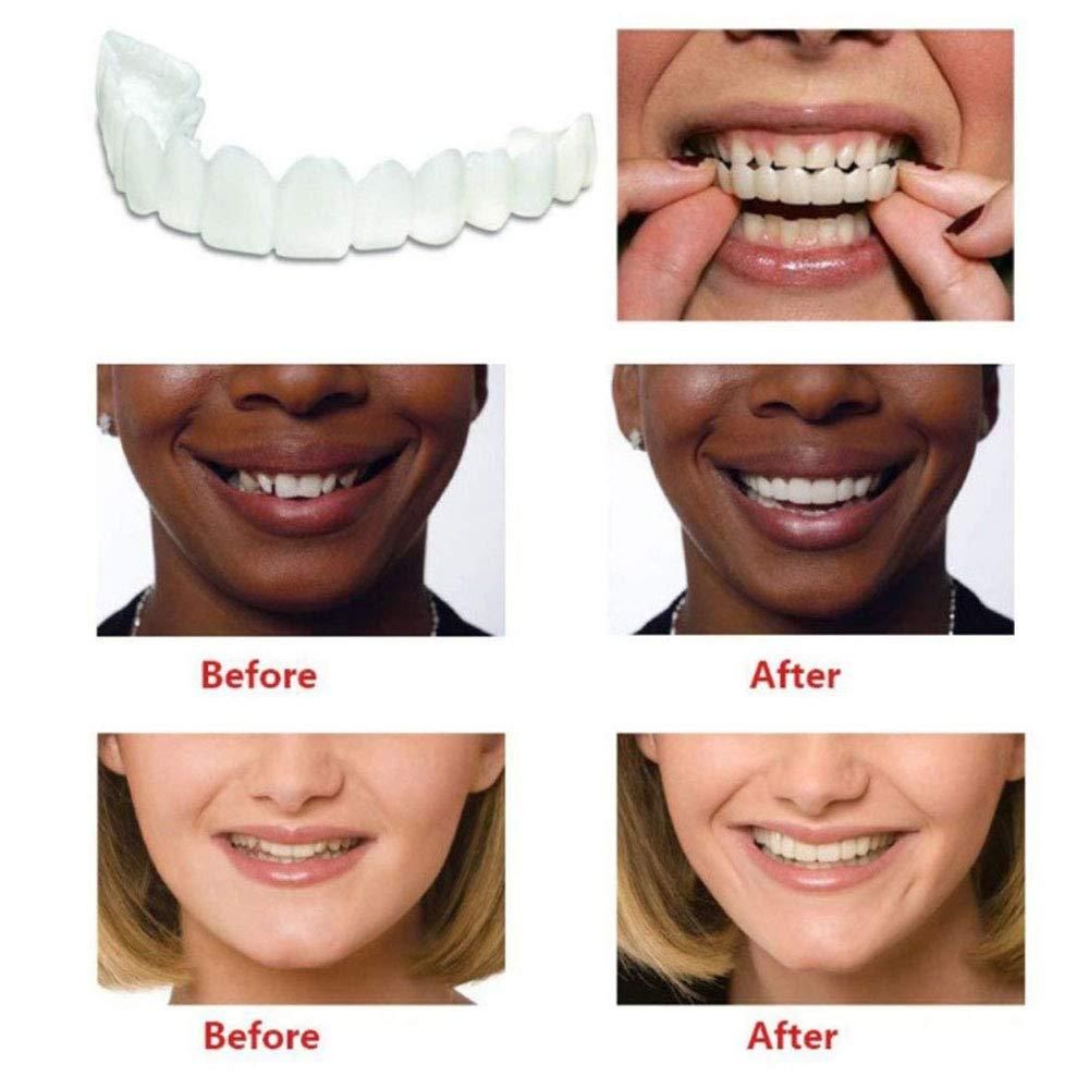 Instant and Confident on Smile Fit Flex Cosmetic Teeth Denture Teeth (Pack of 3)
