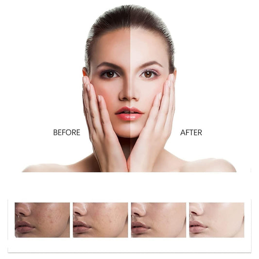 🌟 Whitening Facial Cream – Perfect for Both Men & Women! 🧴✨