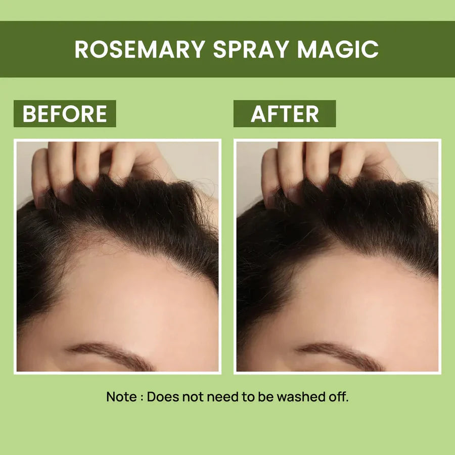 Rosemary Water, Hair Spray For Regrowth (Buy 1 Get 1 Free)